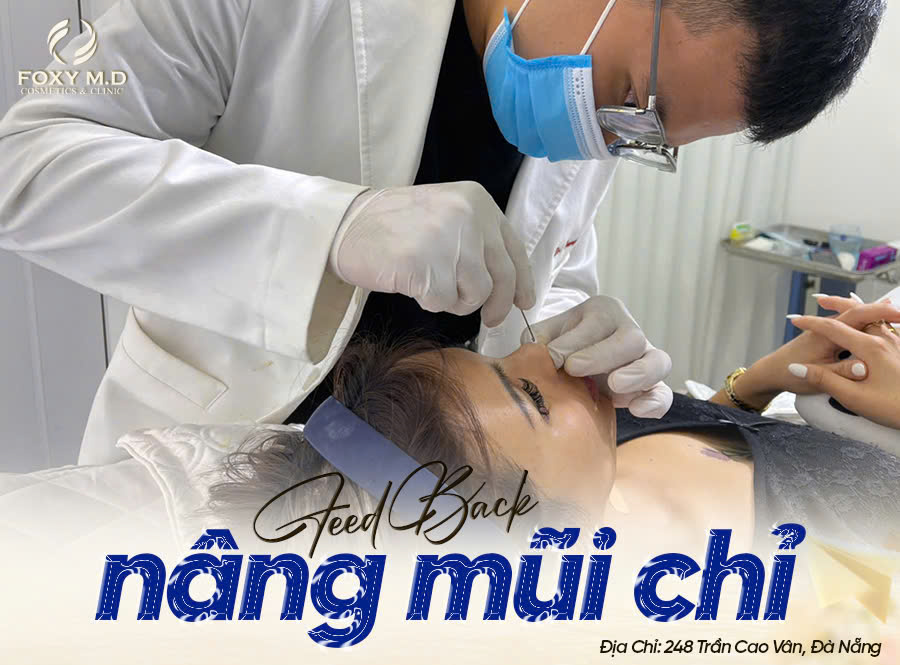 Feedback nâng mũi chỉ: Thực tế có đẹp như lời đồn?
